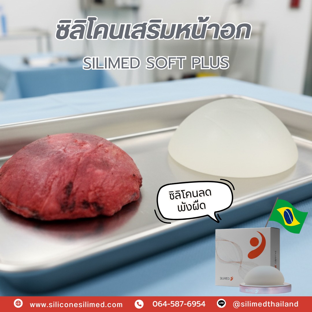 ซิลิโคนเสริมหน้าอกแบบลดพังผืดคืออะไร