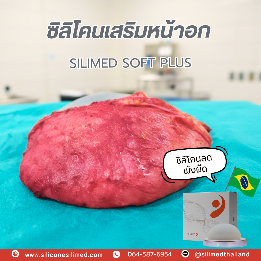 ซิลิโคน ลดพังผืด ซิลิโคน ลดพังผืด