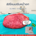 ซิลิโคน ลดพังผืด