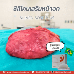 ซิลิโคน ลดพังผืด