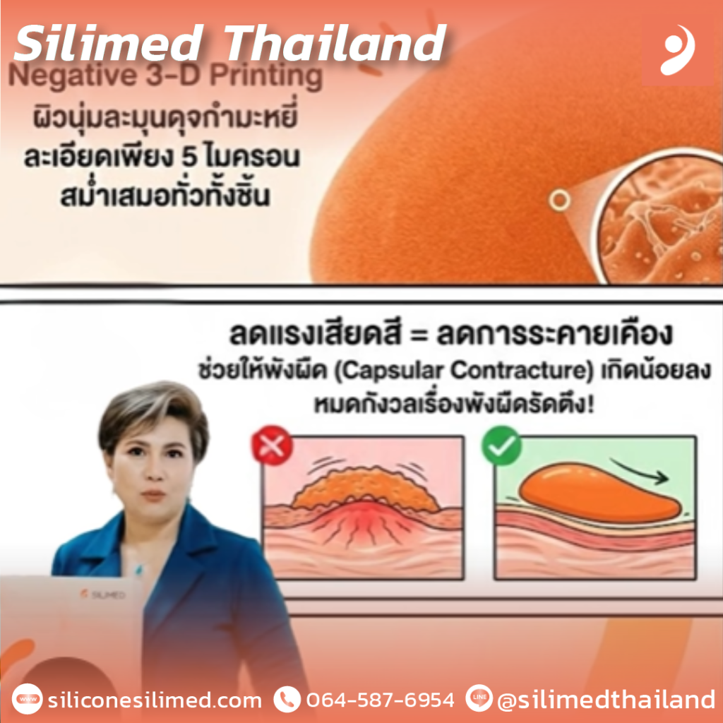 Soft Plus by SILIMED ซิลิโคนเต้านมเทียม