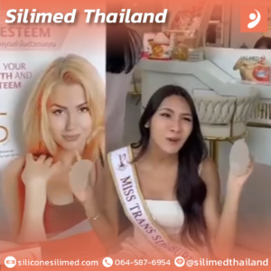 Silicone Silimed ความนุ่มแบบผู้หญิงตัวจริง