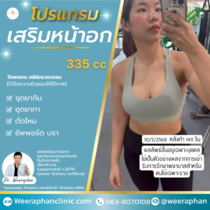 ซิลิเมด ซิลิโคน