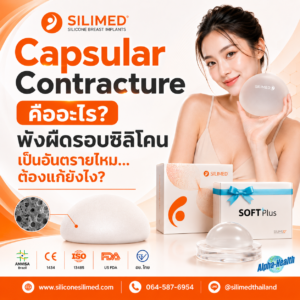 Capsular Contracture คืออะไร